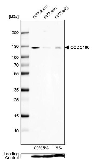 Merck Anti-CCDC186 antibody produced in rabbit