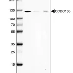 Merck Anti-CCDC186 antibody produced in rabbit