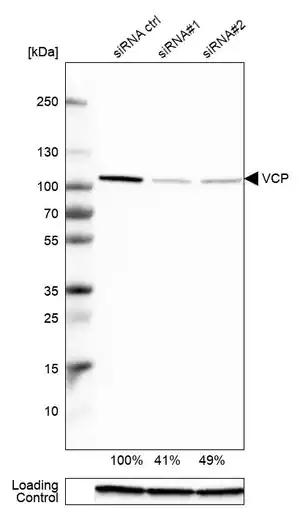 Merck Anti-VCP antibody produced in rabbit