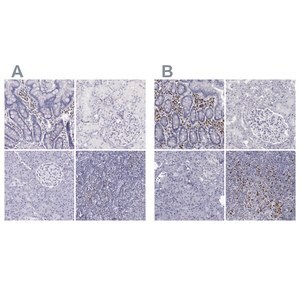 Merck Anti-IRF4 antibody produced in rabbit