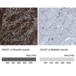 Merck Anti-CALD1 antibody produced in rabbit