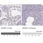 Merck Anti-MAGEC1 antibody produced in rabbit