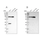 Merck Anti-MTDH antibody produced in rabbit