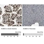 Merck Anti-ACBD5 antibody produced in rabbit