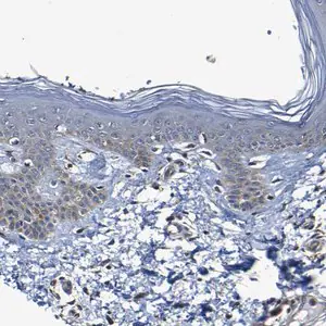 Merck Anti-ADAM15 antibody produced in rabbit