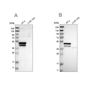 Merck Anti-KRT23 antibody produced in rabbit