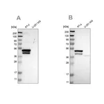 Merck Anti-KRT23 antibody produced in rabbit