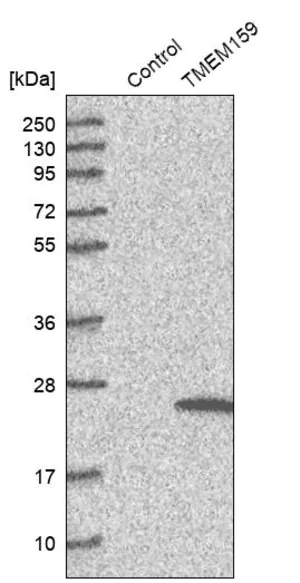 Merck Anti-TMEM159 antibody produced in rabbit