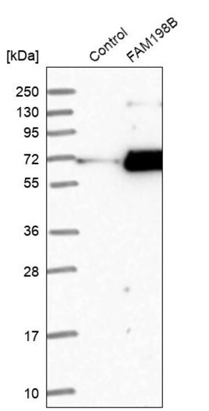 Merck Anti-FAM198B antibody produced in rabbit