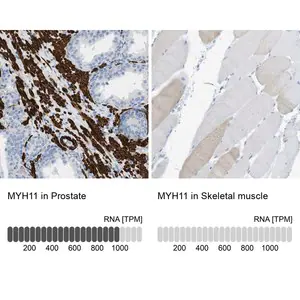 Merck Anti-MYH11 antibody produced in rabbit