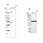 Merck Anti-SMARCB1 antibody produced in rabbit
