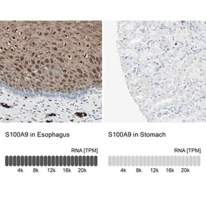 Merck Anti-S100A9 antibody produced in rabbit