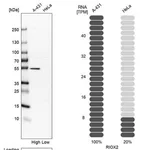 Merck Anti-RIOX2 antibody produced in rabbit