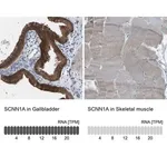 Merck Anti-SCNN1A antibody produced in rabbit