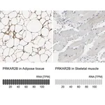 Merck Anti-PRKAR2B antibody produced in rabbit