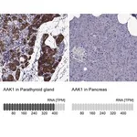 Merck Anti-AAK1 antibody produced in rabbit