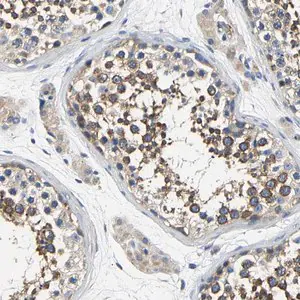 Merck Anti-CSDE1 antibody produced in rabbit