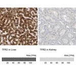 Merck Anti-TFR2 antibody produced in rabbit