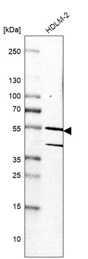 Merck Anti-RIOX2 antibody produced in rabbit