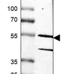 Merck Anti-RIOX2 antibody produced in rabbit