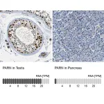 Merck Anti-PARN antibody produced in rabbit