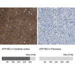 Merck Anti-ATP1B2 antibody produced in rabbit