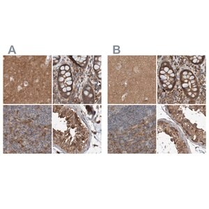 Merck Anti-ARHGEF11 antibody produced in rabbit
