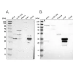 Merck Anti-PHYH antibody produced in rabbit