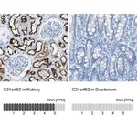 Merck Anti-C21orf62 antibody produced in rabbit