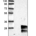 Merck Anti-GIMAP2 antibody produced in rabbit