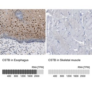 Merck Anti-CSTB antibody produced in rabbit