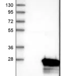 Merck Anti-RBBP9 antibody produced in rabbit