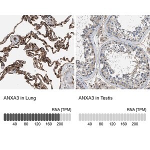 Merck Anti-ANXA3 antibody produced in rabbit