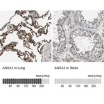 Merck Anti-ANXA3 antibody produced in rabbit