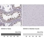 Merck Anti-DDX20 antibody produced in rabbit