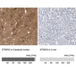 Merck Anti-STMN3 antibody produced in rabbit