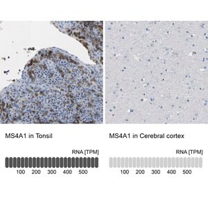 Merck Anti-MS4A1 antibody produced in rabbit