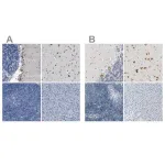 Merck Anti-B4GALNT1 antibody produced in rabbit