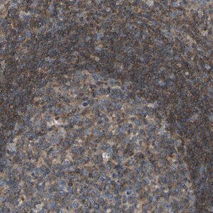 Merck Anti-GRK6 antibody produced in rabbit