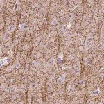 Merck Anti-SIRT2 antibody produced in rabbit
