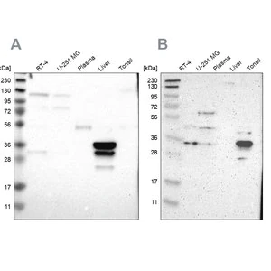 Merck Anti-PHYH antibody produced in rabbit