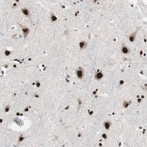 Merck Anti-POGZ antibody produced in rabbit