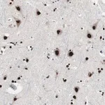 Merck Anti-POGZ antibody produced in rabbit