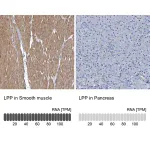 Merck Anti-LPP antibody produced in rabbit
