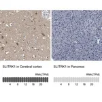 Merck Anti-SLITRK1 antibody produced in rabbit