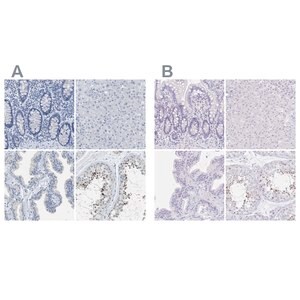 Merck Anti-EQTN antibody produced in rabbit