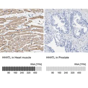 Merck Anti-HHATL antibody produced in rabbit