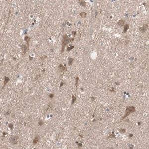 Merck Anti-ADAP1 antibody produced in rabbit