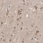 Merck Anti-ADAP1 antibody produced in rabbit