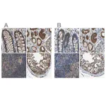 Merck Anti-FHIT antibody produced in rabbit